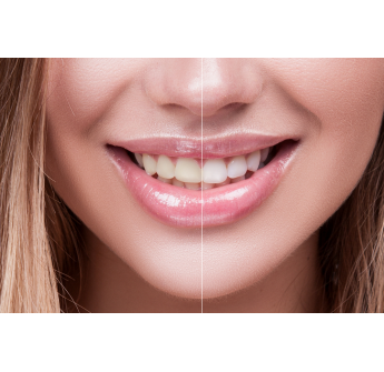 Sr Dental Agiz Ve Dis Sagligi Poliklinigi Bergama Izmir